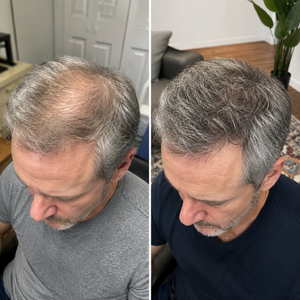 GHK-Cu Hair & Scalp Serum
