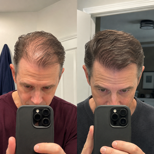 GHK-Cu Hair & Scalp Serum