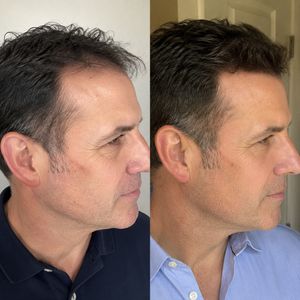 GHK-Cu Hair & Scalp Serum