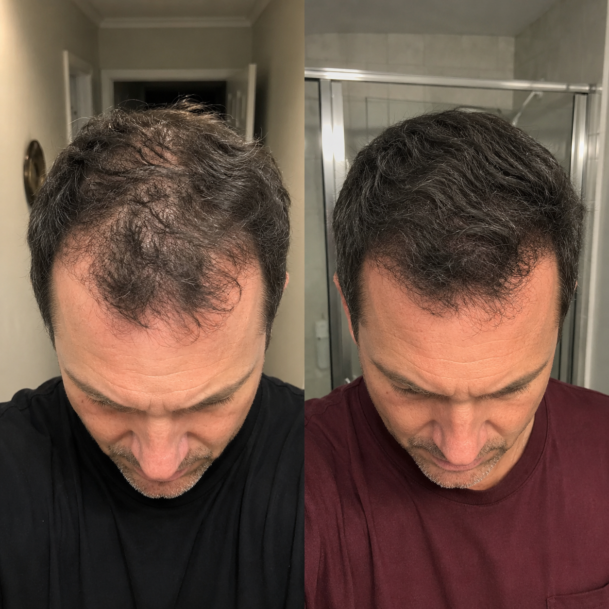 Hair Fullness – Before & After