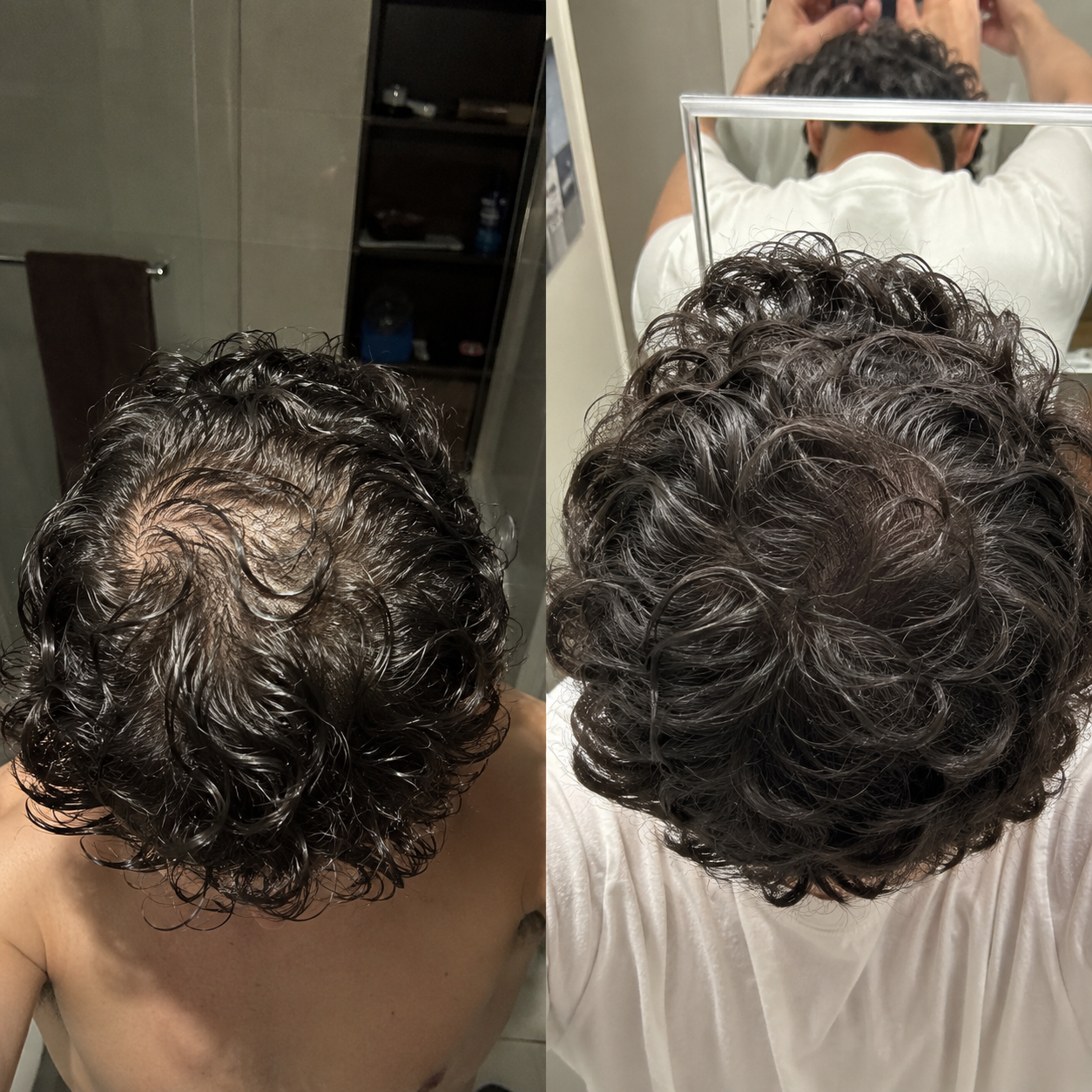 Crown Density – Before & After