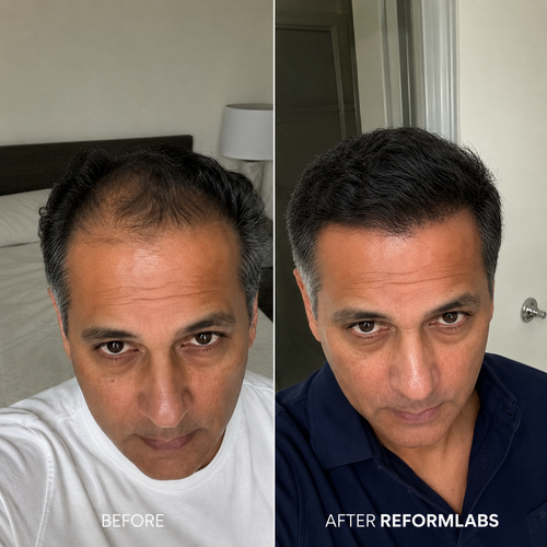 Hair & Scalp Serum